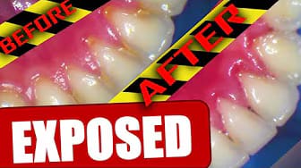 Post 1 by Dr Kamel AlSalek on YouTube (video)
