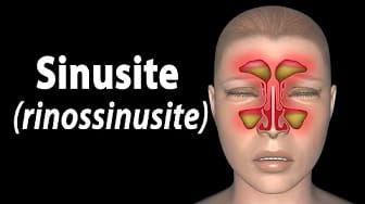 Post 9 by Alila Medical Media em Português on YouTube (video)