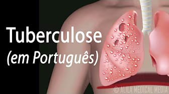 Post 4 by Alila Medical Media em Português on YouTube (video)