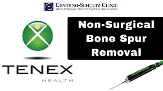 Post 3 by Dr. Markle: Regenerative Orthopedics Expert on YouTube (video)