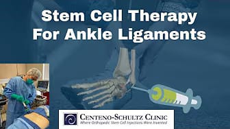 Post 4 by Dr. Markle: Regenerative Orthopedics Expert on YouTube (video)