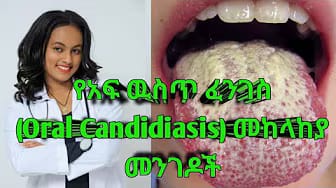 Post 10 by Elshu Medic Tube on YouTube (video)