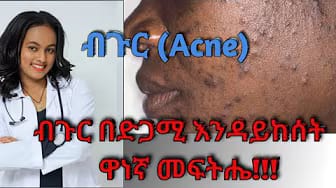 Post 9 by Elshu Medic Tube on YouTube (video)
