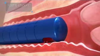 Post 2 by The SHAW Center Plastic Surgery on YouTube (video)