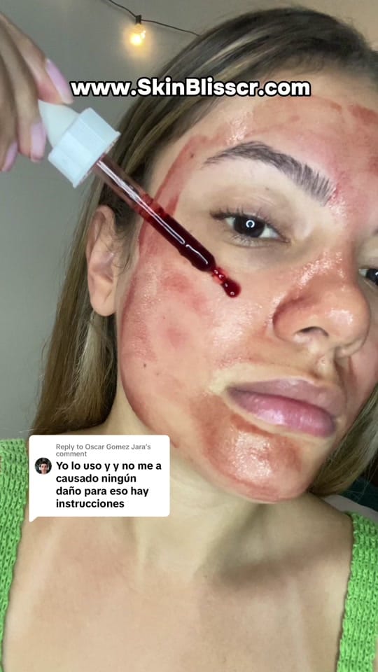 Post 9 by Skin Bliss Shop on TikTok (video)