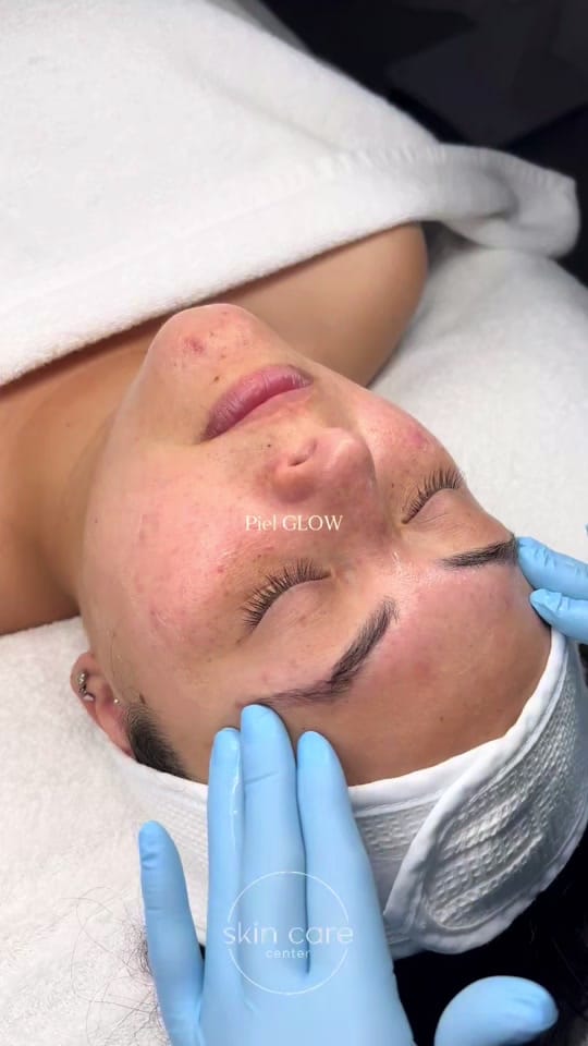 Post 3 by Skincare Center on TikTok (video)
