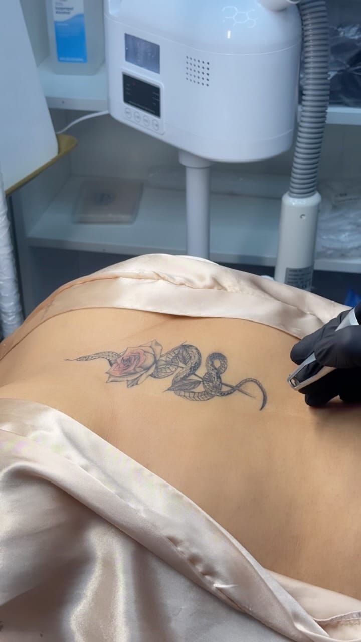 Post 3 by Alexander Medina | Depilación Láser & Estética on Instagram (video)