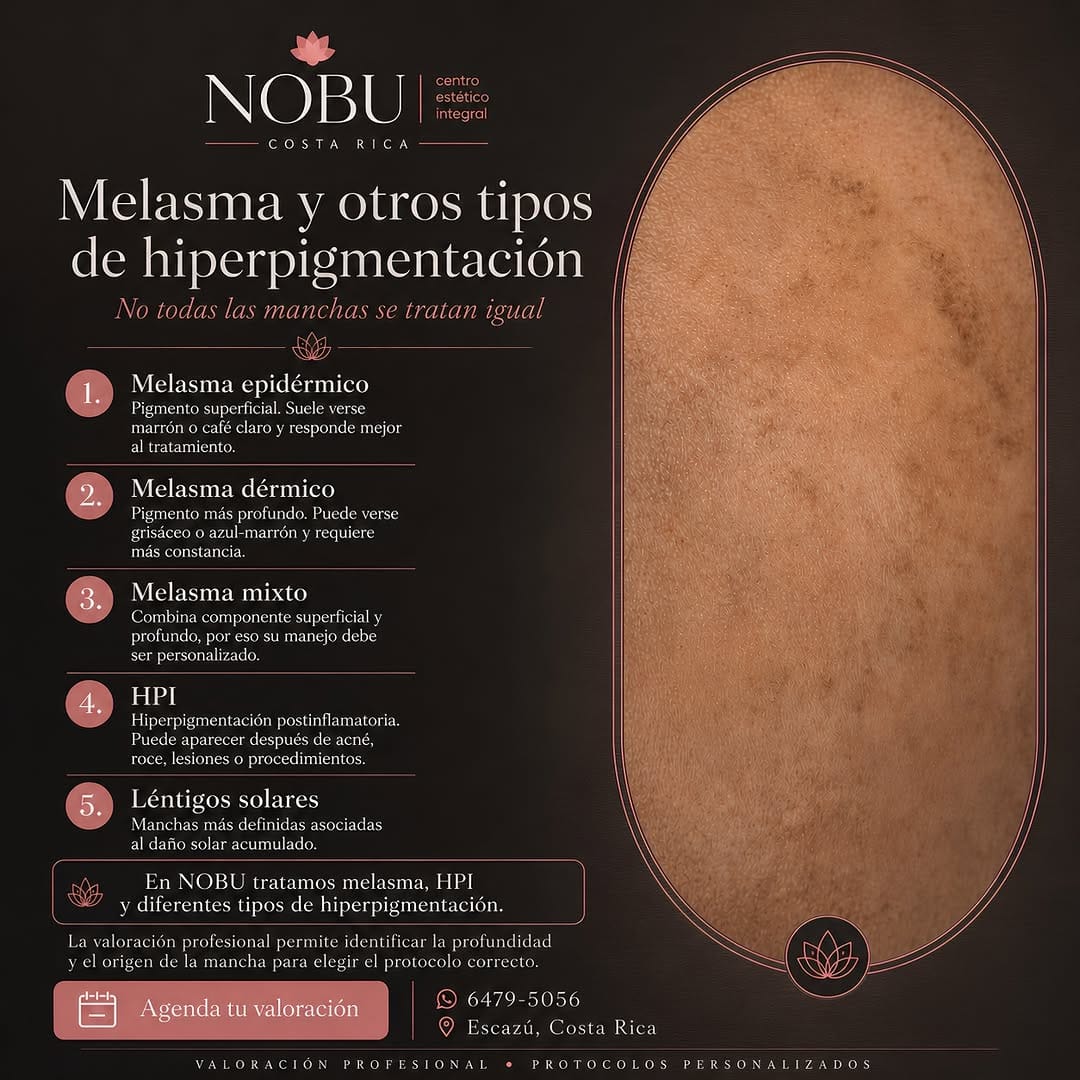 Post 5 by NOBU Estética & Spa | Escazú on Instagram (image)