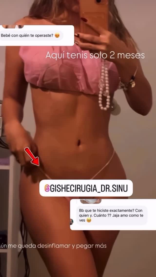 Post 9 by Gishe Cirugía Plástica on Instagram (video)