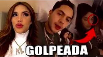 Post 10 by Jorge Vizcarra on YouTube (video)