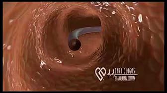 Post 6 by Cardiologos Guadalajara on YouTube (video)