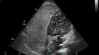 Post 4 by Cardiologos Guadalajara on YouTube (video)