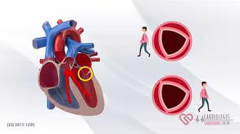 Post 1 by Cardiologos Guadalajara on YouTube (video)