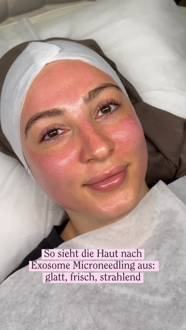 Post 9 by MSLY AESTHETICS on Instagram (video)