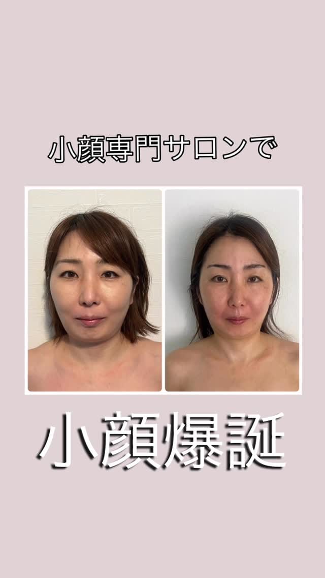 Post 1 by minori  小顔サロンL'AZUR/小顔矯正スクール/大阪/心斎橋 on Instagram (video)