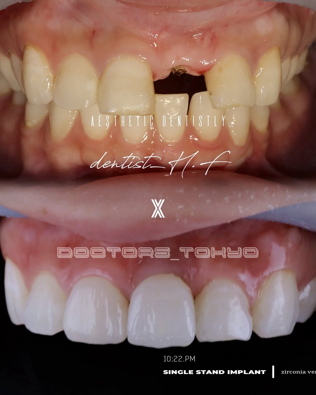 Post 5 by 🦋𝓣𝓞𝓜𝓞𝓚𝓞 on Instagram (image)