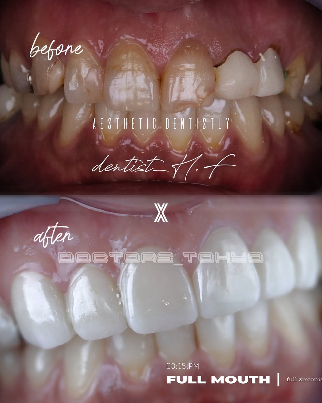 Post 4 by 🦋𝓣𝓞𝓜𝓞𝓚𝓞 on Instagram (image)