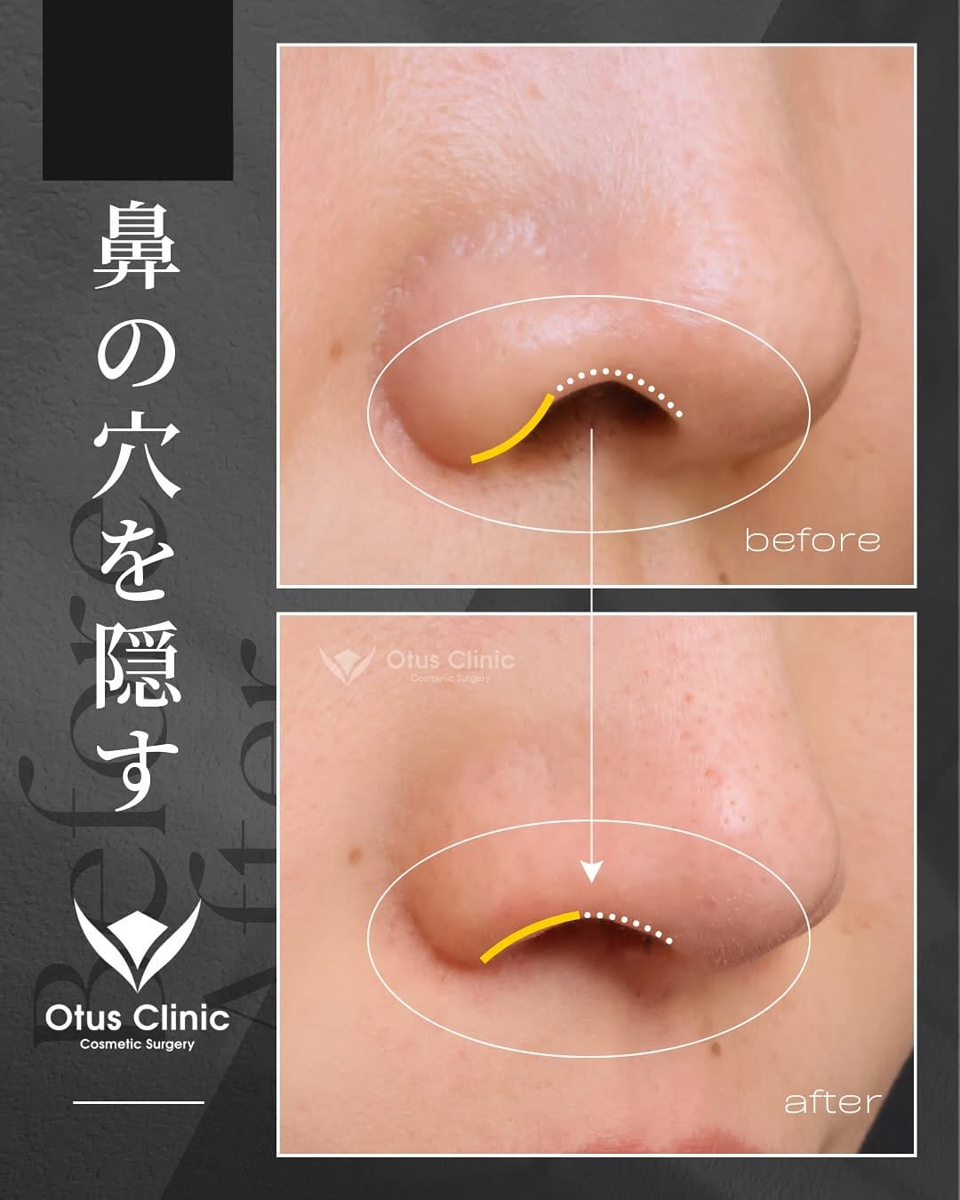 Post 8 by Otus Clinic｜オータスクリニック on Instagram (carousel)