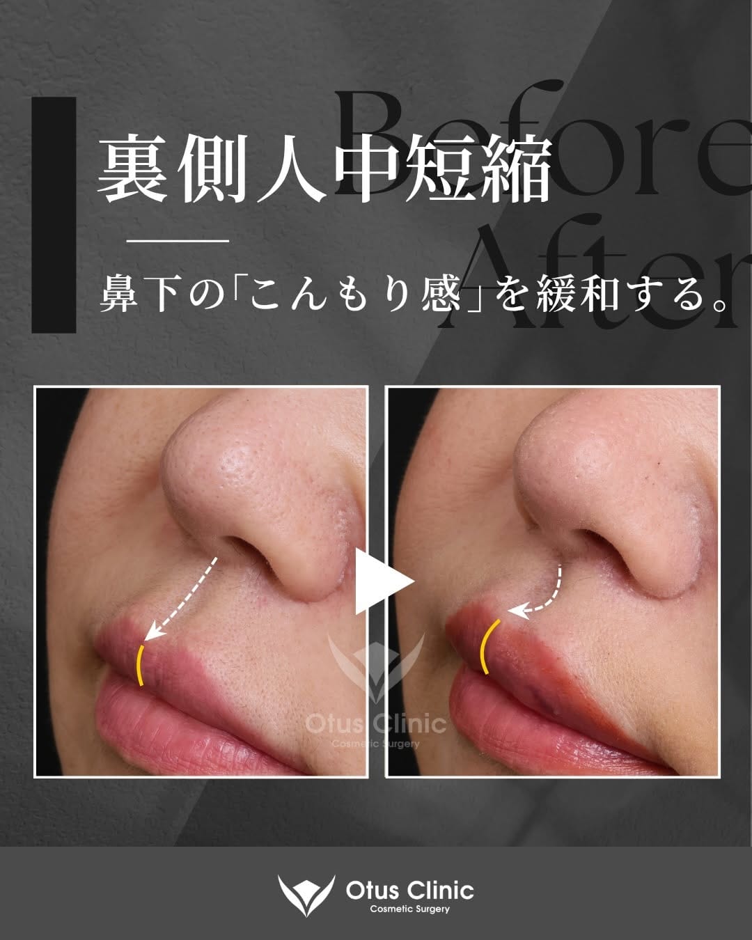 Post 5 by Otus Clinic｜オータスクリニック on Instagram (carousel)