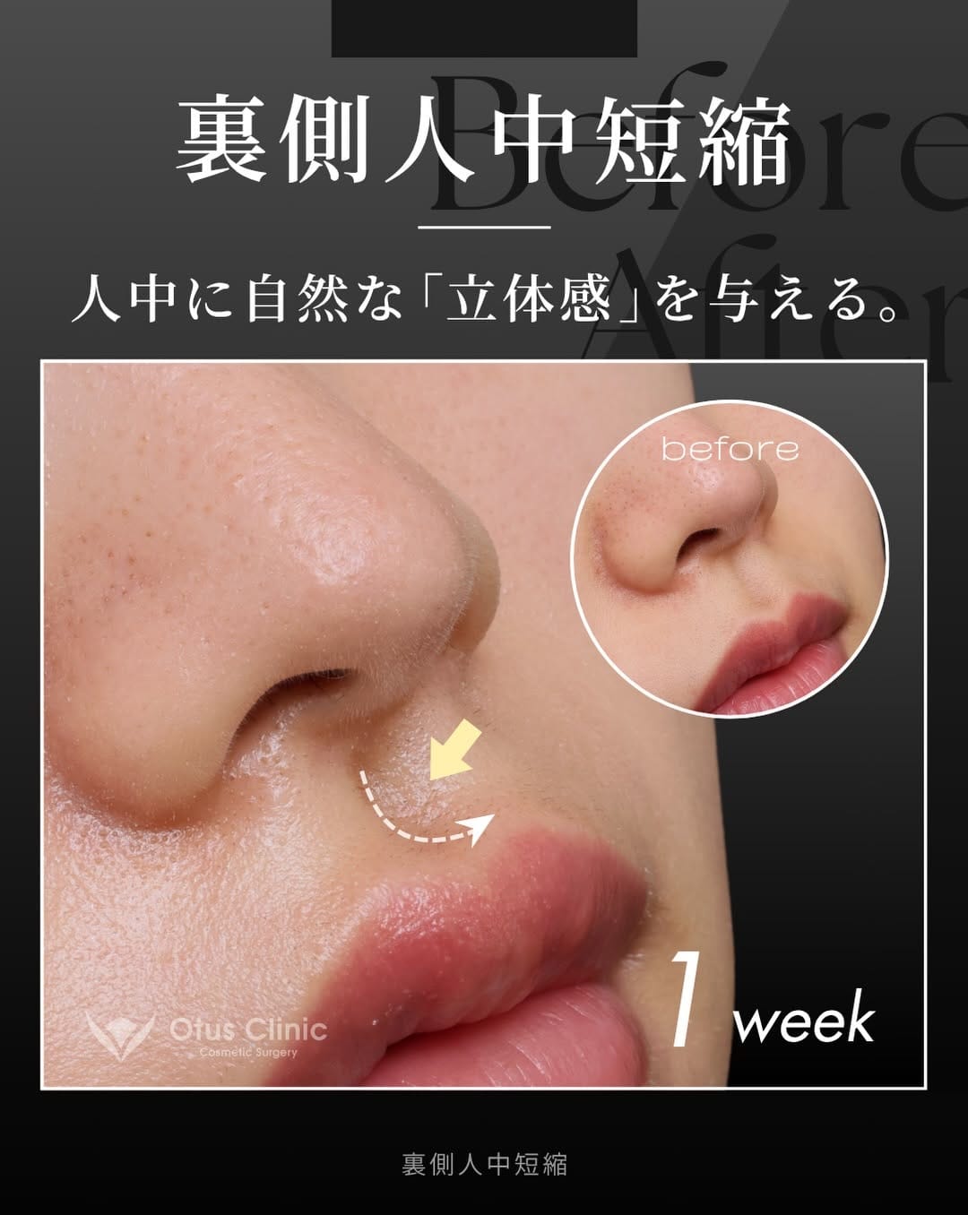 Post 6 by Otus Clinic｜オータスクリニック on Instagram (carousel)