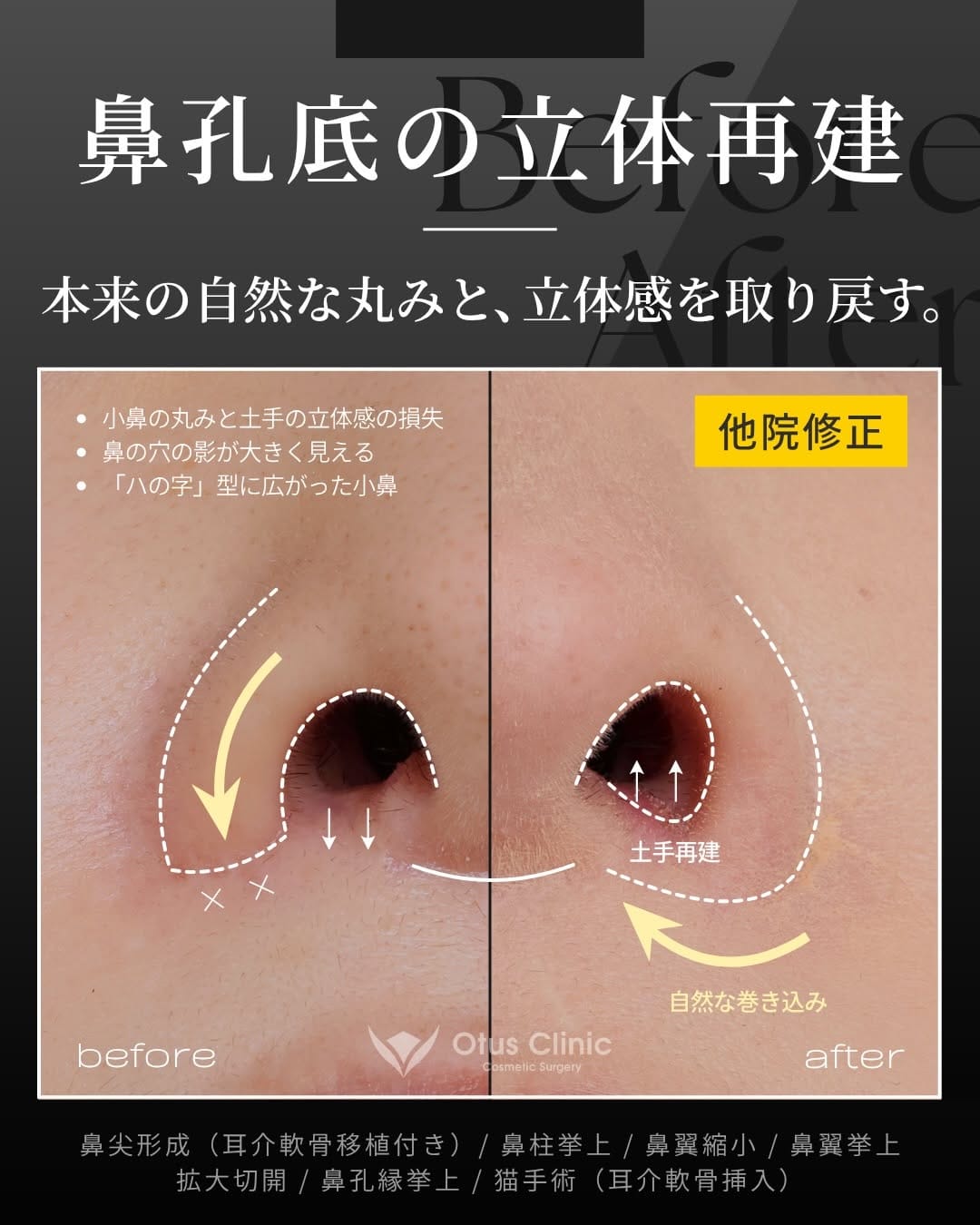 Post 4 by Otus Clinic｜オータスクリニック on Instagram (carousel)