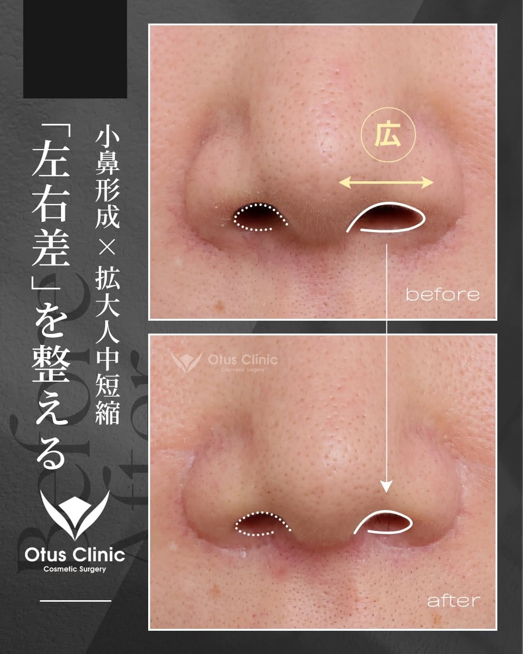 Post 1 by Otus Clinic｜オータスクリニック on Instagram (carousel)