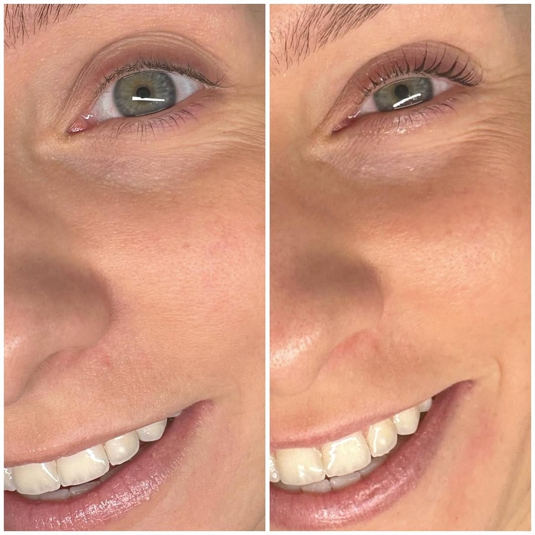 Post 4 by Lash Lifting Master on Instagram (image)