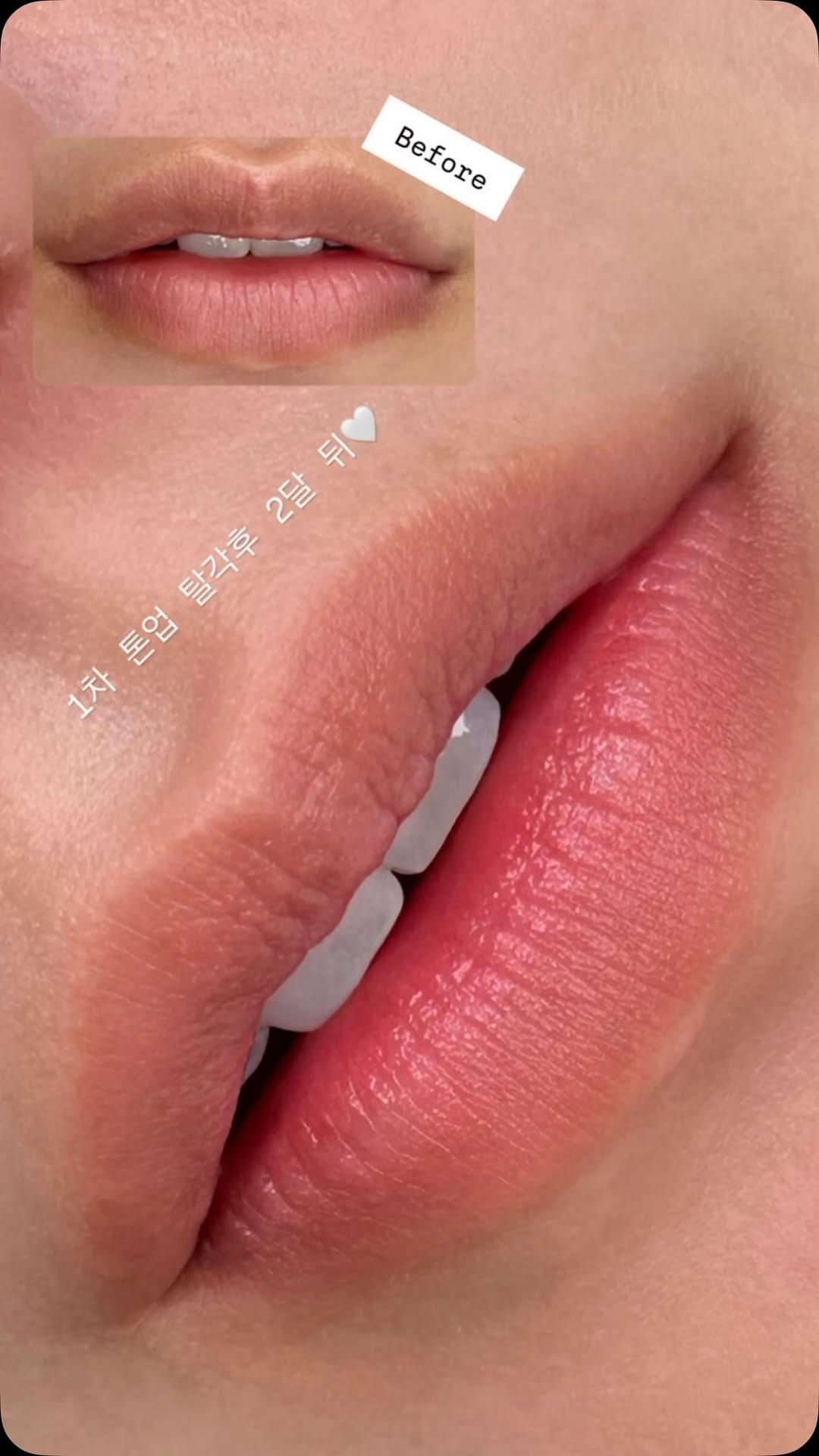 Post 3 by 眉アート 天才 🌐 Global K-PMU 앙쥬브로우 강남 눈썹문신 입술문신 リップ  アートメイク on Instagram (video)