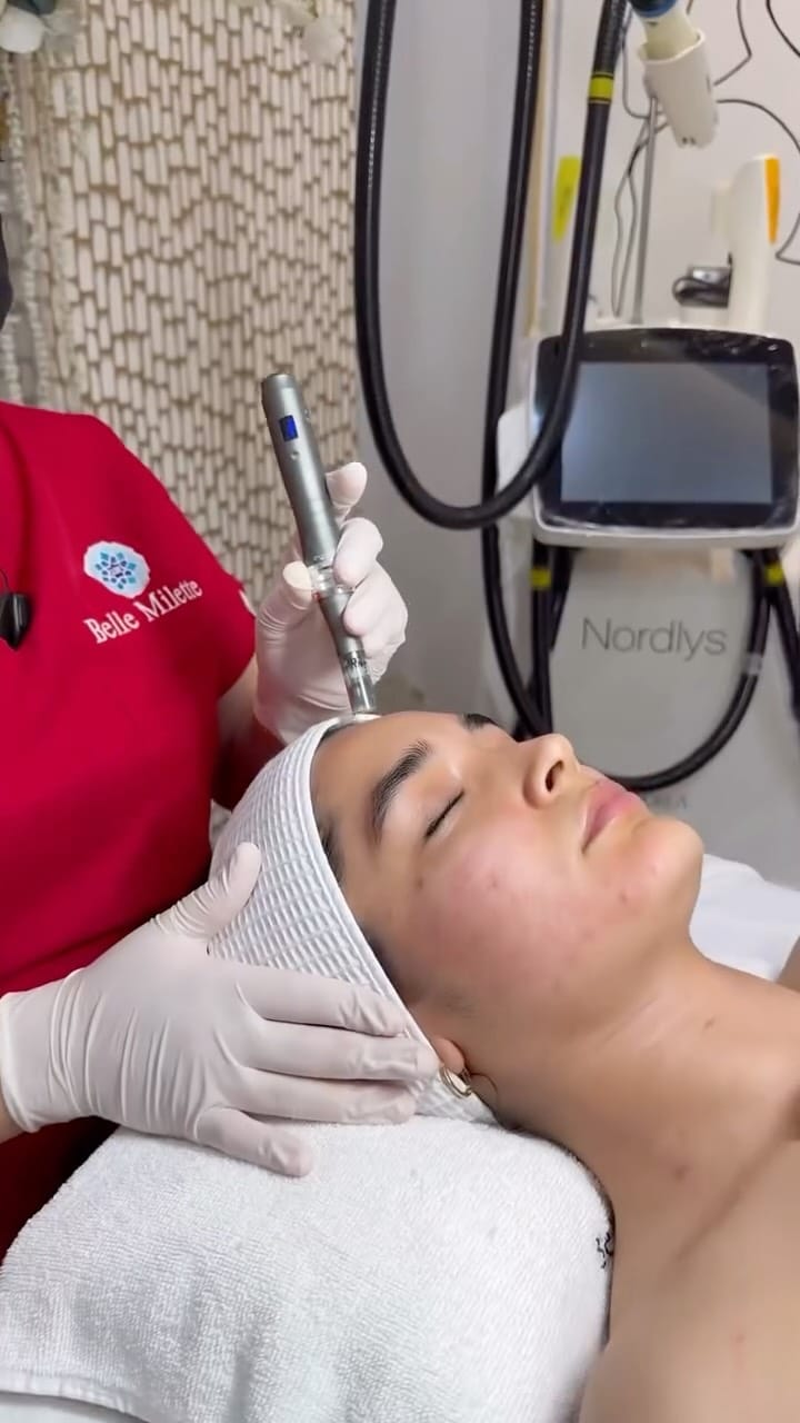 Post 6 by BELLE MILETTE SPA on Instagram (video)