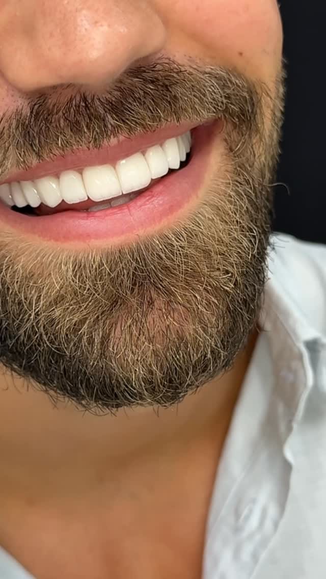 Post 5 by 𝘿𝙧. 𝙃𝙚𝙡𝙖 𝙍𝙖𝙠𝙮 🦷 د. هيلـه راقـي on Instagram (video)