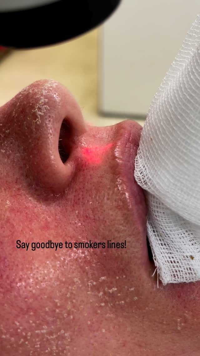 Post 10 by Dr. med. Melis Andersen on Instagram (video)
