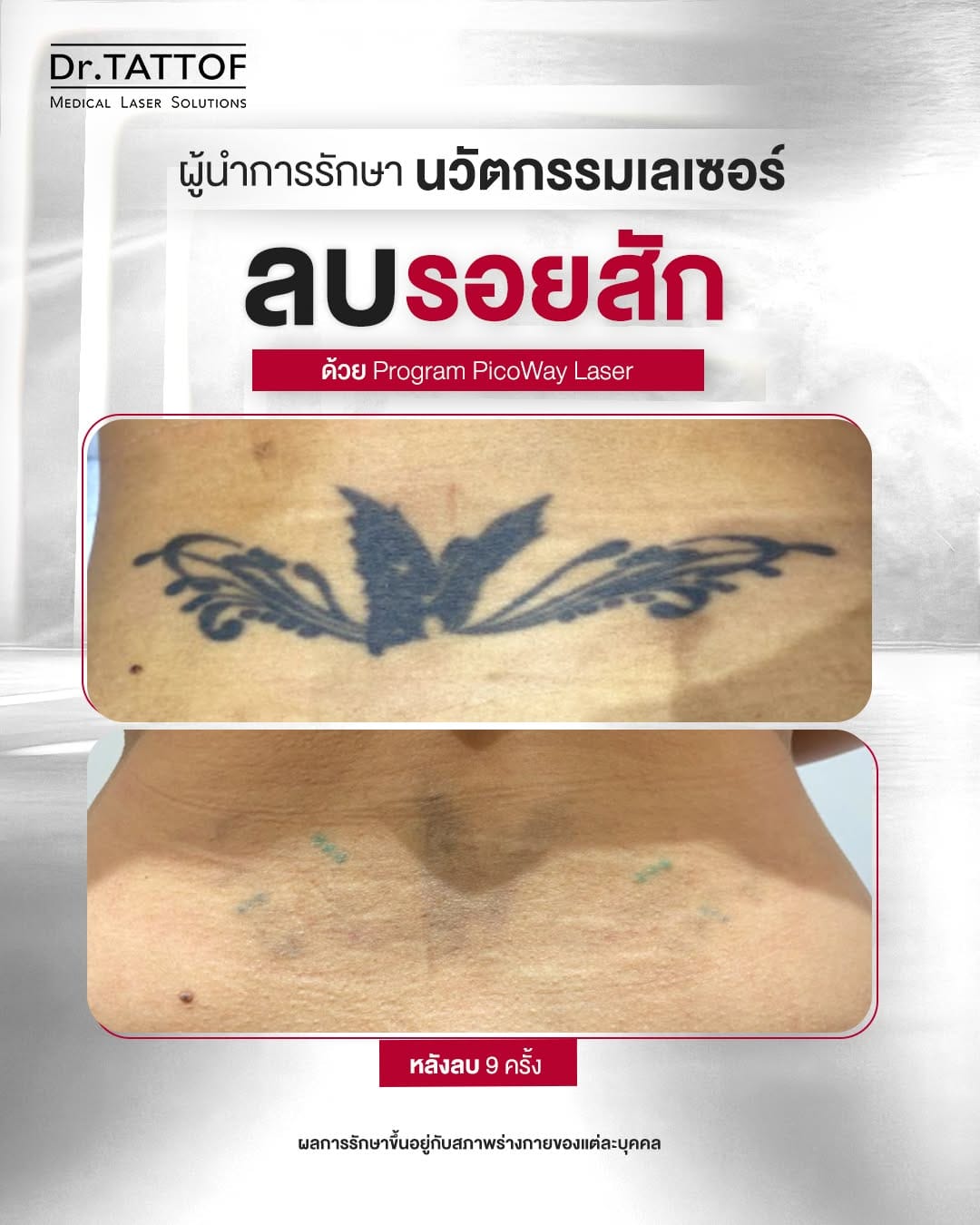 Post 3 by Dr.TATTOF on Instagram (image)