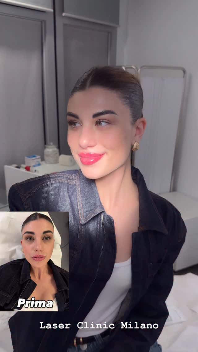 Post 5 by LASER CLINIC MILANO | Chirurgia Plastica | Rimozione tatuaggi on Instagram (video)