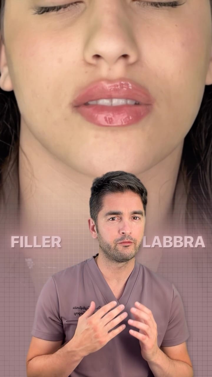 Post 1 by Dott. Pierluigi Gigliofiorito | Chirurgo Plastico & Estetico on Instagram (video)