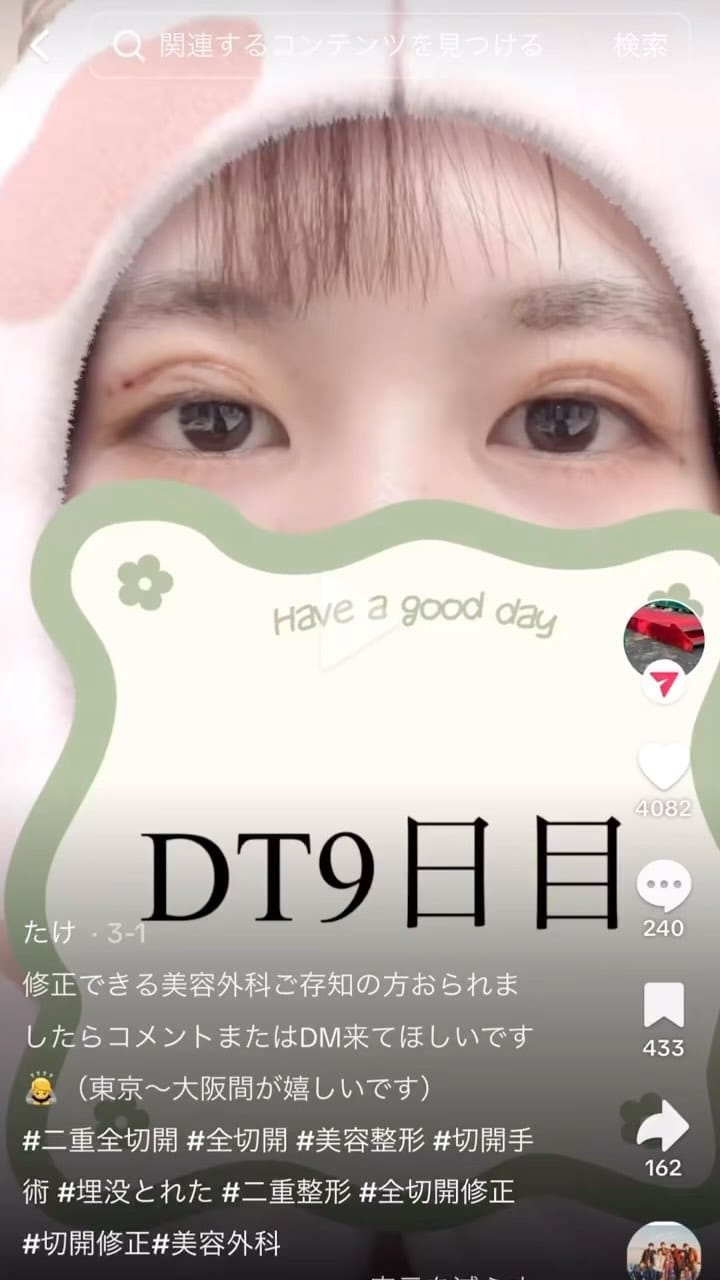 Post 7 by 【絶対美感】 前田 進太郎（眼瞼下垂/脂肪吸引/豊胸） on Instagram (video)