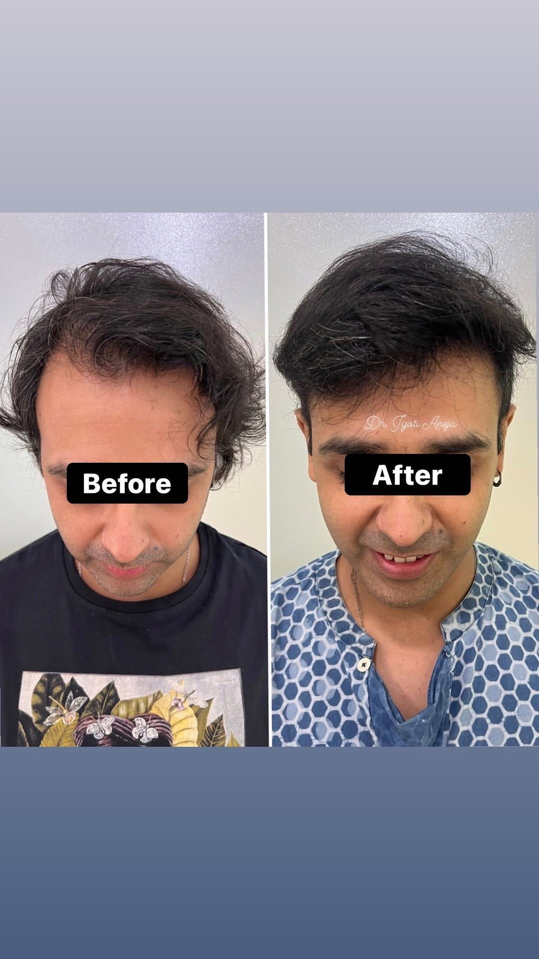 Post 8 by DR JYOTI ANEJA on Instagram (video)