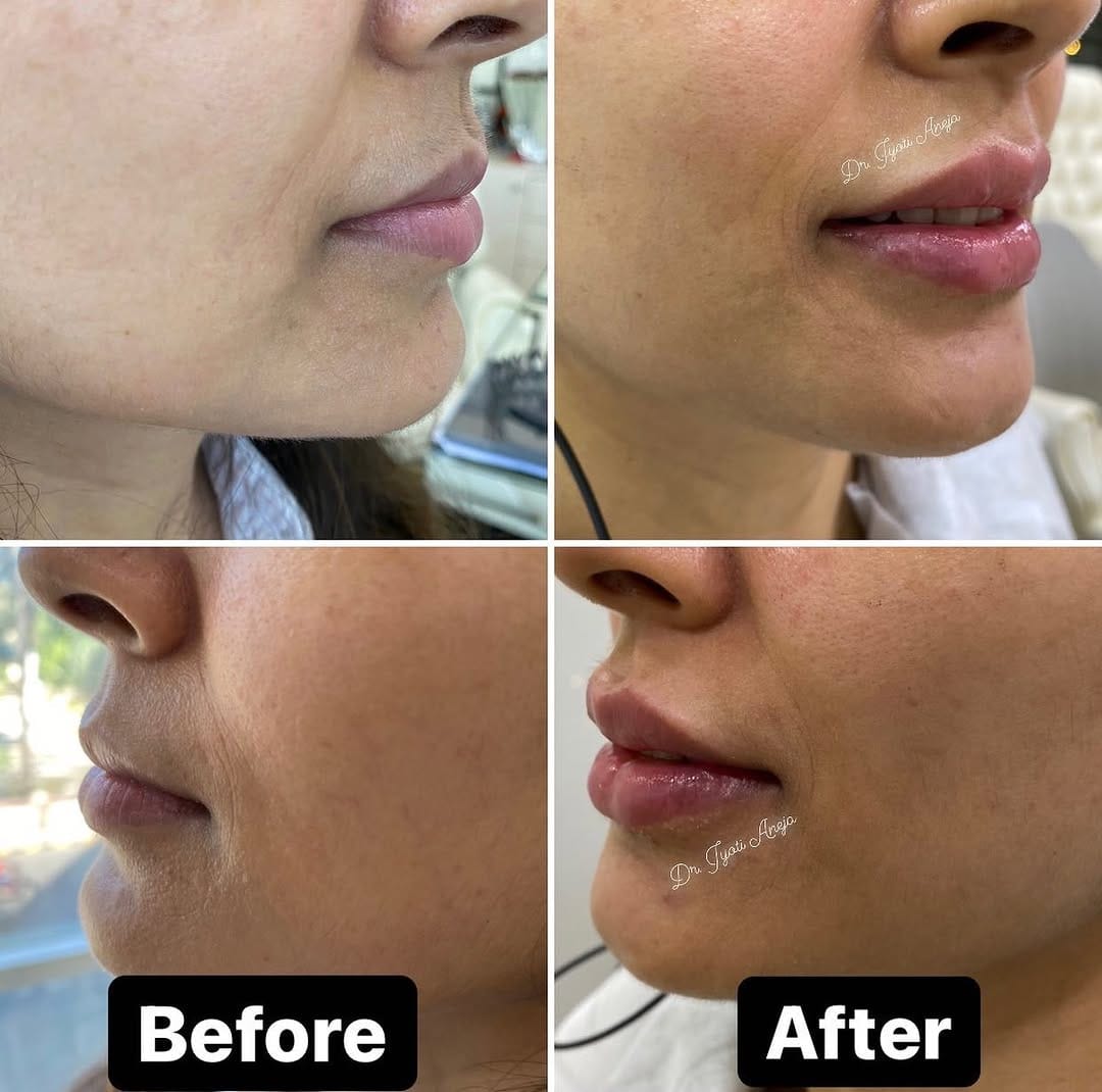 Post 10 by DR JYOTI ANEJA on Instagram (image)