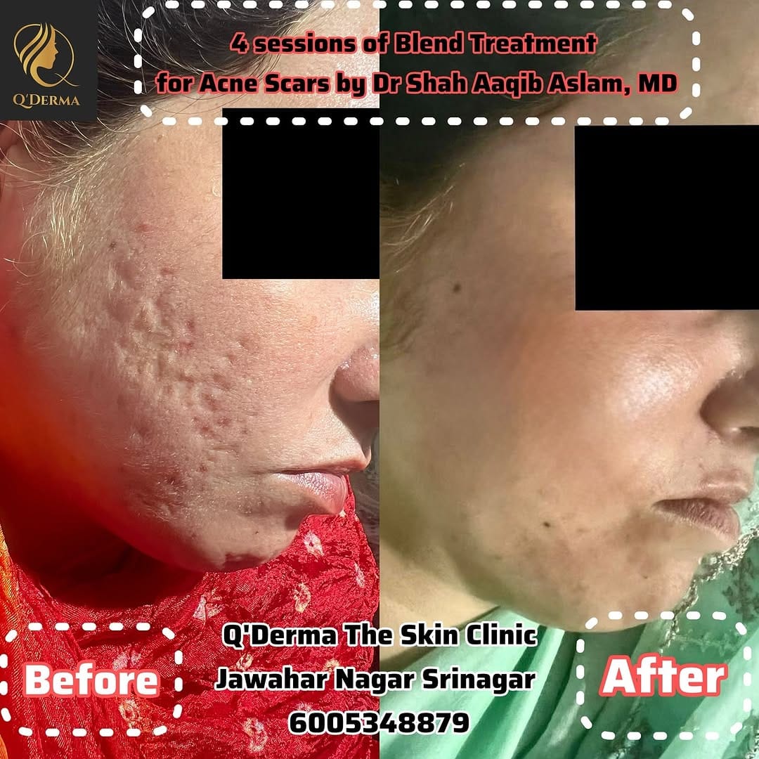 Post 10 by Dr Shah Aaqib Aslam, MD ™️ : Dermatology & Aesthetics on Instagram (image)