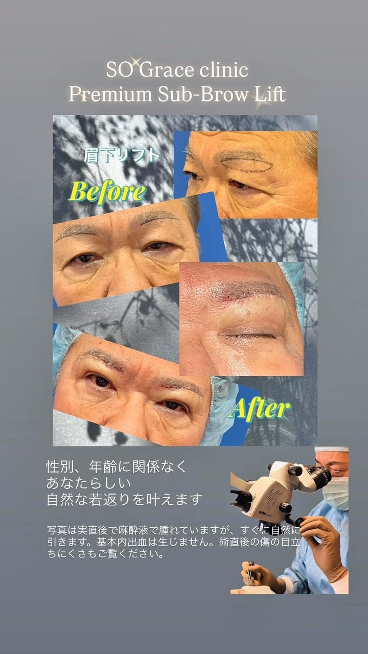 Post 5 by Dr. Soichiro Kondo on Instagram (video)