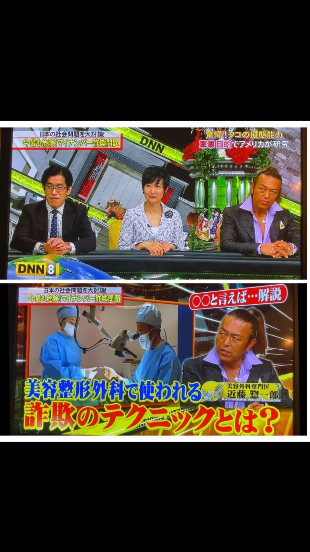 Post 10 by Dr. Soichiro Kondo on Instagram (video)