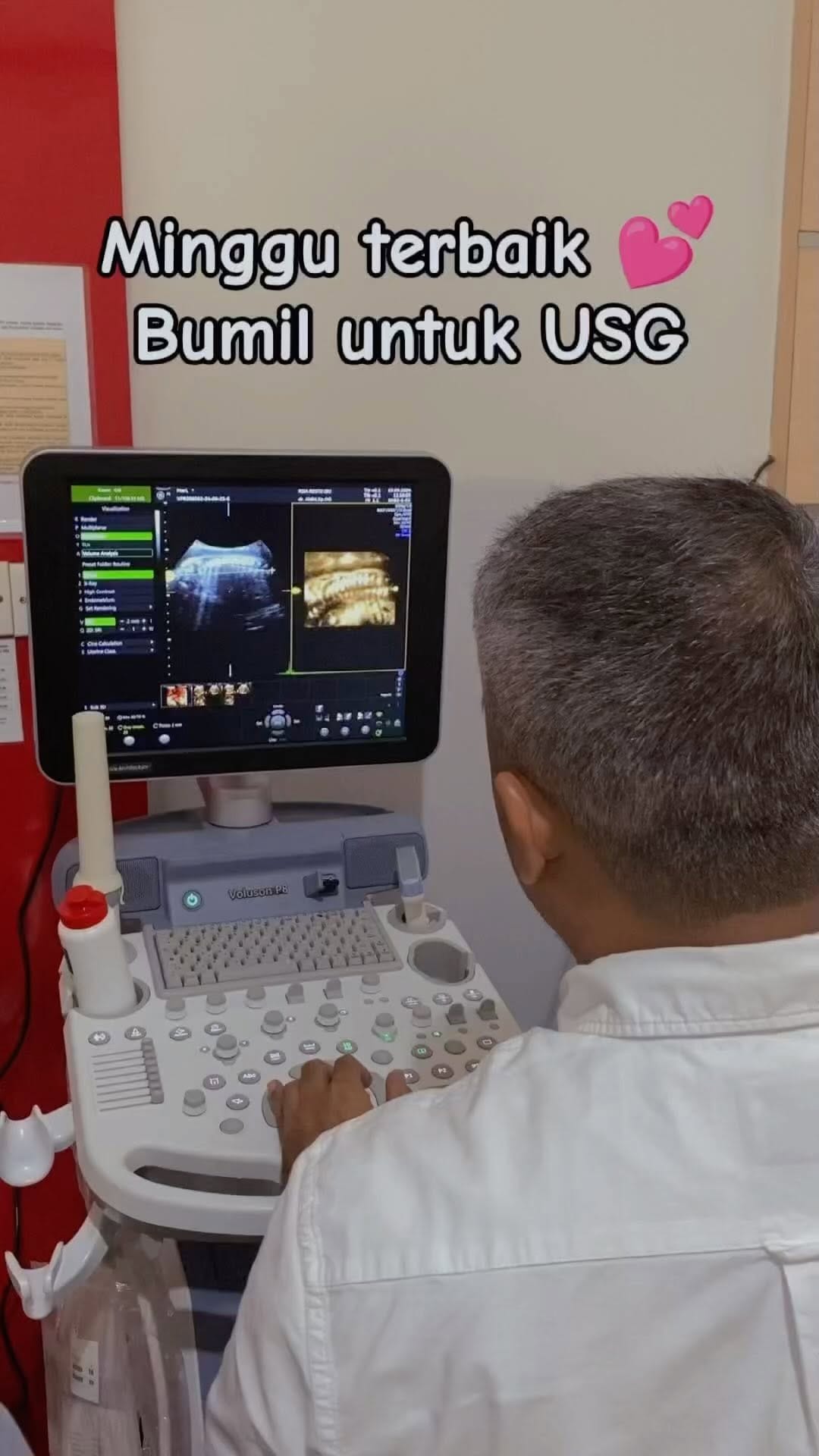 Post 10 by RSIA Restu Ibu Padang on Instagram (video)