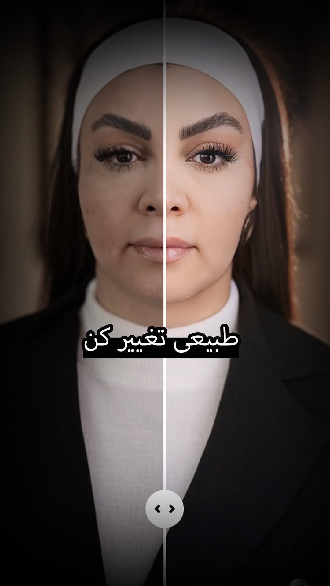 Post 10 by دکتر پیمان داودی | Dr Davoodi on Instagram (video)