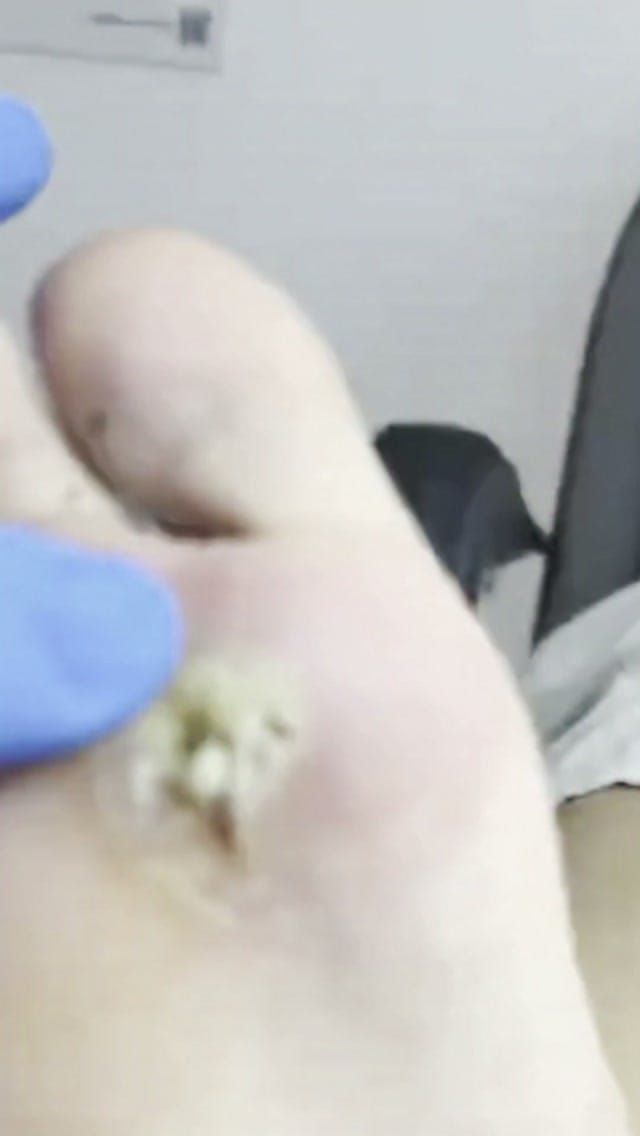 Post 5 by HALINA THE CUPPING CLINIC on Instagram (video)