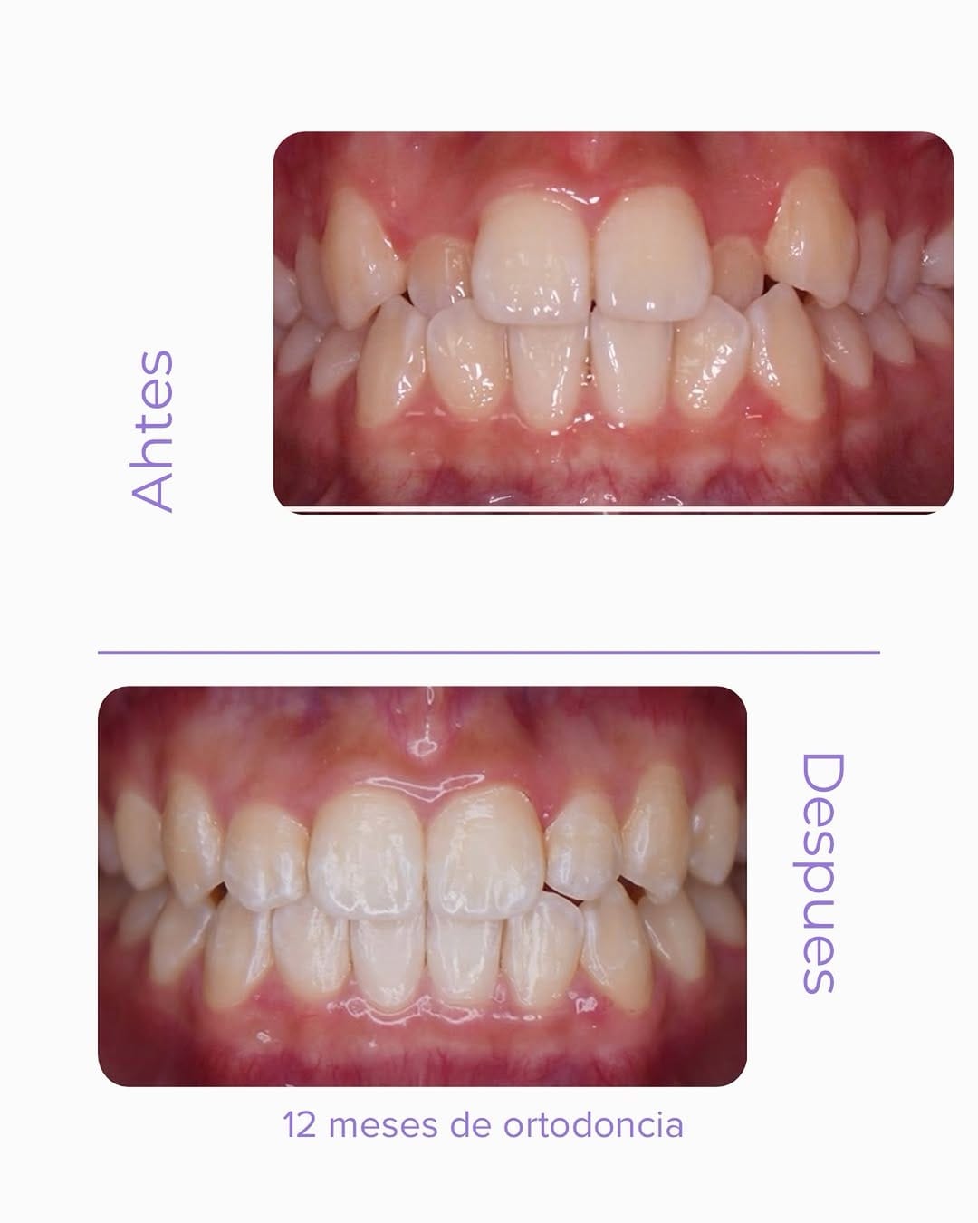 Post 7 by Clínica Dental | Love Dental and Esthetic on Instagram (image)