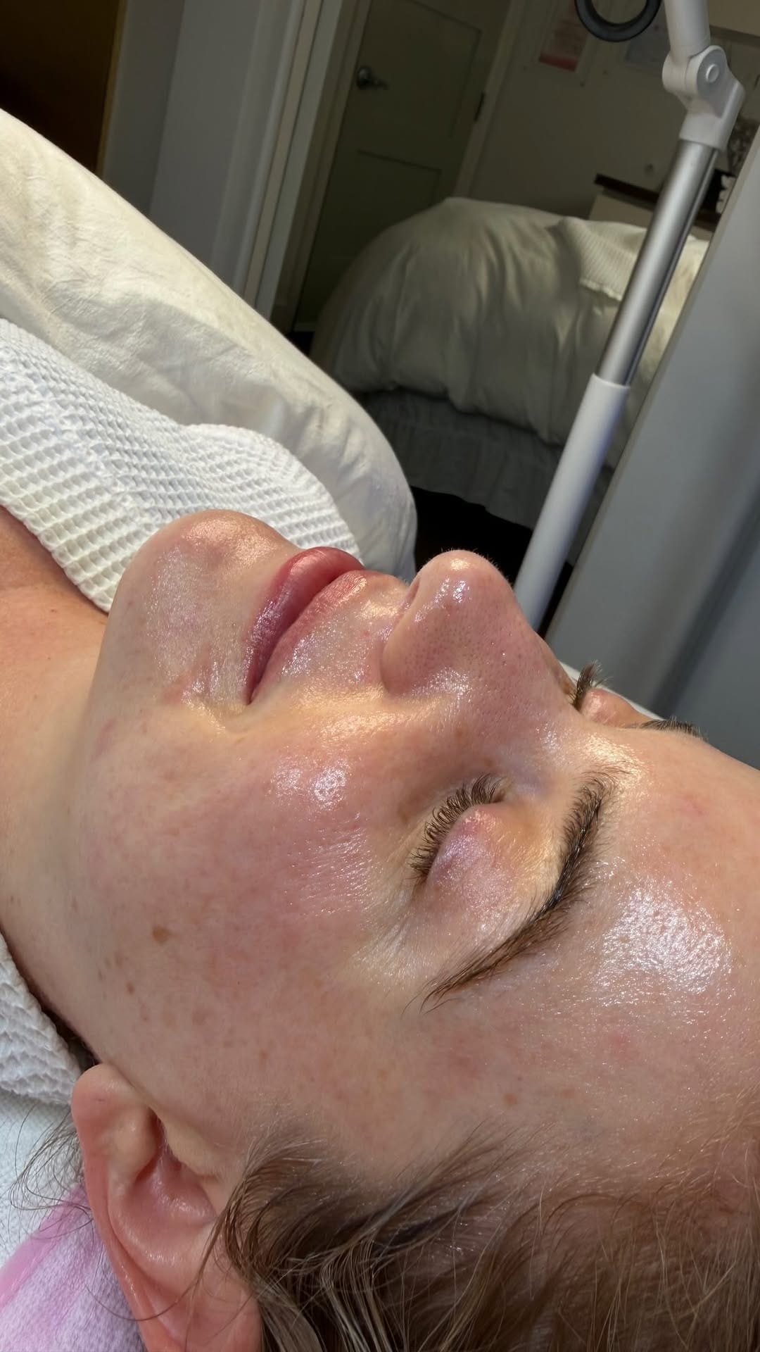 Post 5 by Aesthetician Eda Bulgan on Instagram (video)