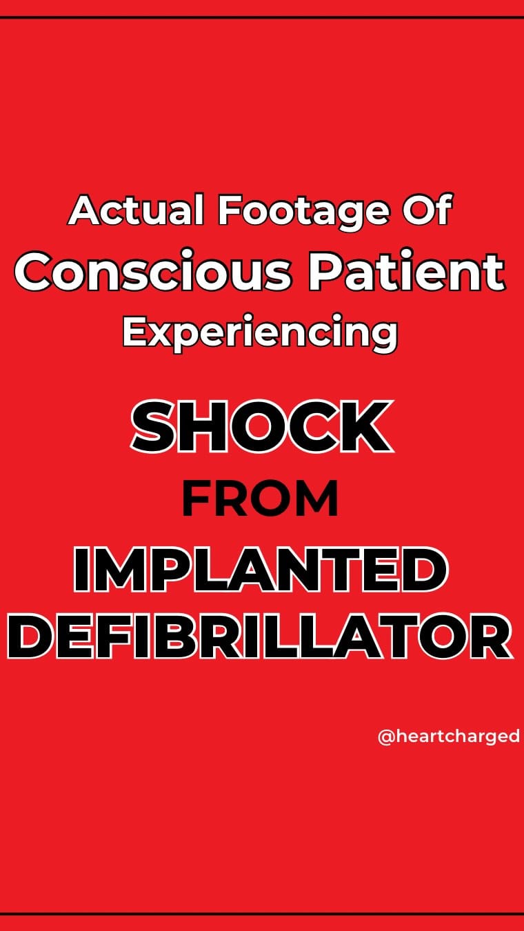 Post 9 by Antonino Di Franco, MD FACC FSIC on Instagram (video)