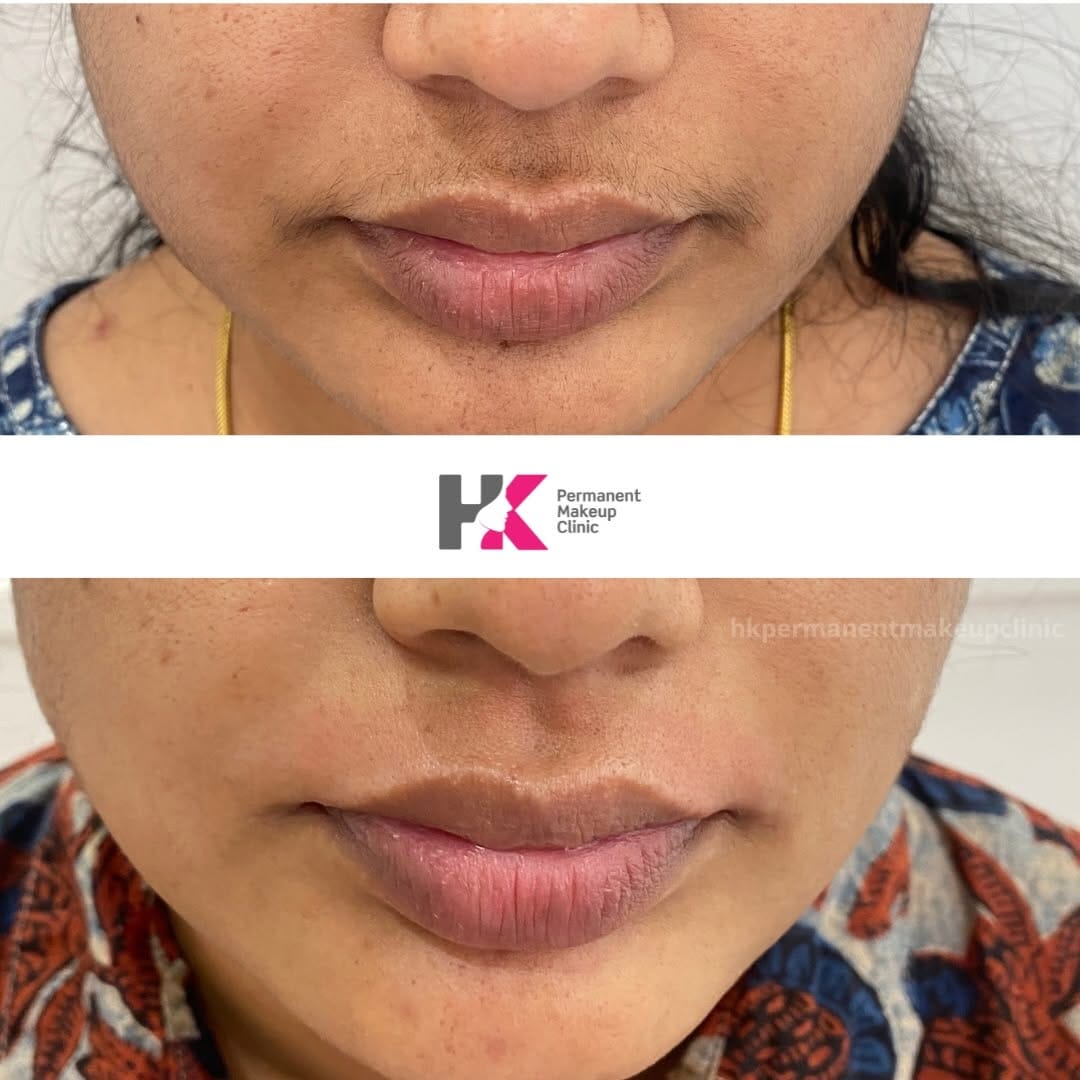 Post 5 by HK Permanent Makeup Clinic on Instagram (image)