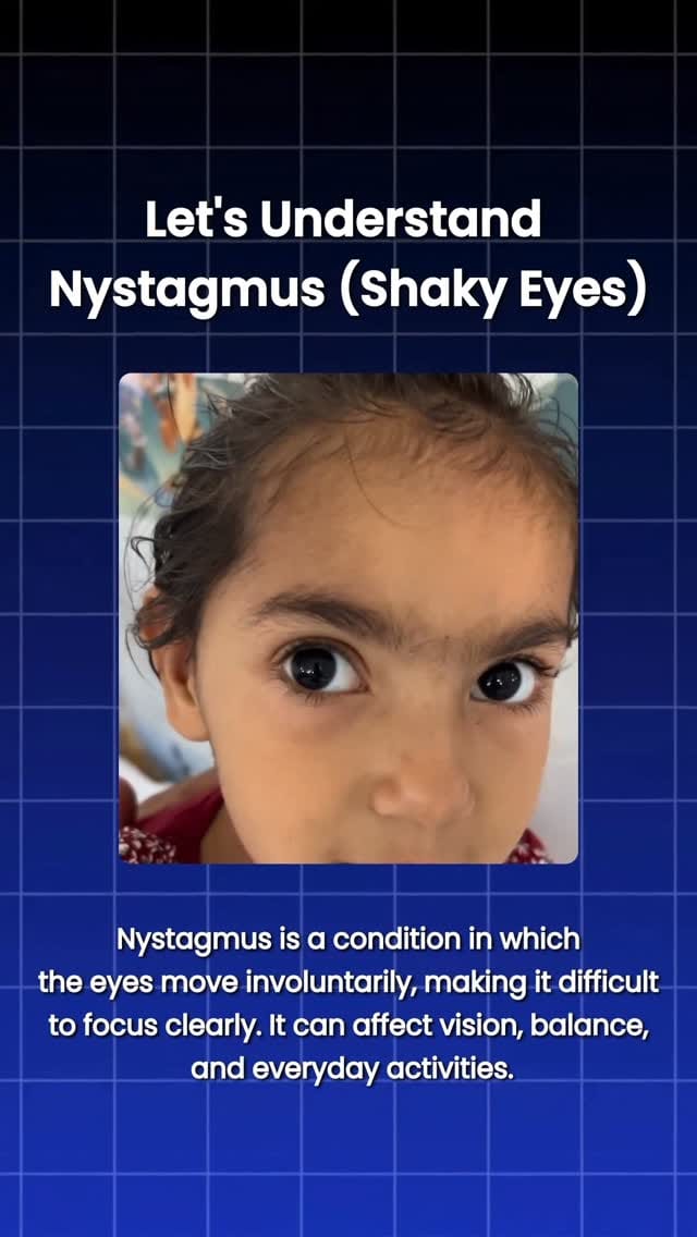 Post 7 by SHREE RETINA CARE EYE HOSPITAL on Instagram (video)