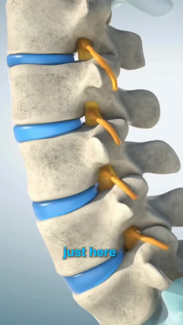 Post 10 by Physio MSK on Instagram (video)