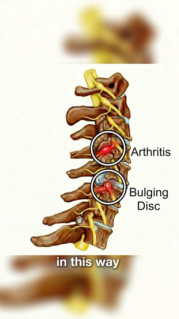Post 7 by Physio MSK on Instagram (video)